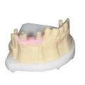 type-d-gingiva (1).jpg
