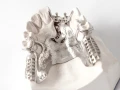 blue-dental-cast-2524532.jpg
